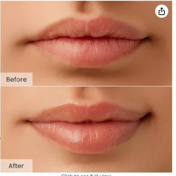 CNP Honey Lip Butter - Propolis Lipcerin - Picture 3 of 6